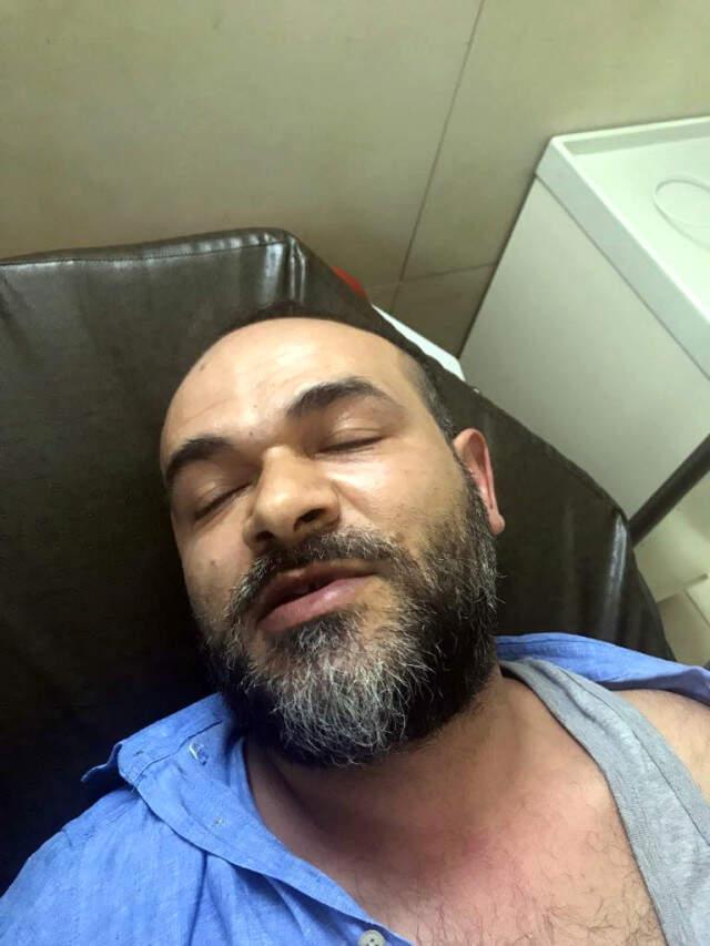 Arkadaşına Borcunu Ödememek İçin Kendisini Vurdurtmuş...