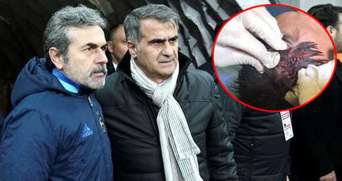 Aykut Kocaman: Kafa Yarılması Skrtel'deki Gibi Olur