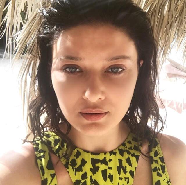 Botoks Mağduru Nurgül Yeşilçay, Bu Kez Köpekbalığı Ciğeri Kullandı