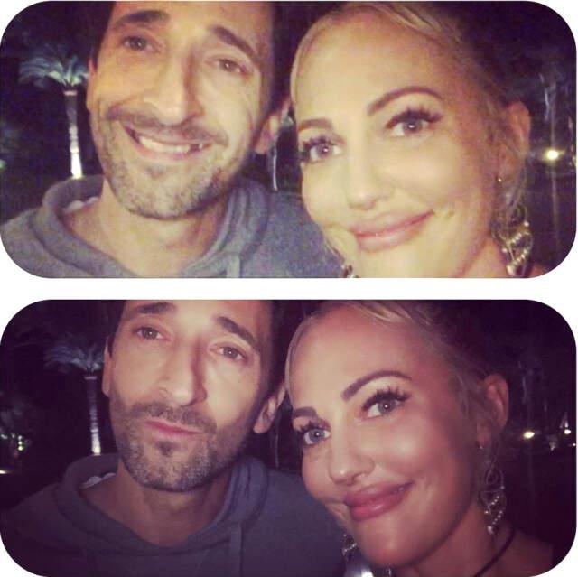 Estetiği Abartan Meryem Uzerli'nin Dudaklarını Gören Şaşıp Kalıyor