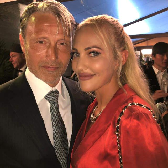 Estetiği Abartan Meryem Uzerli'nin Dudaklarını Gören Şaşıp Kalıyor