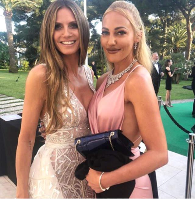 Dolgularıyla Eleştirilere Maruz Kalan Meryem Uzerli Doğal Haline Dönmeye Karar Verdi