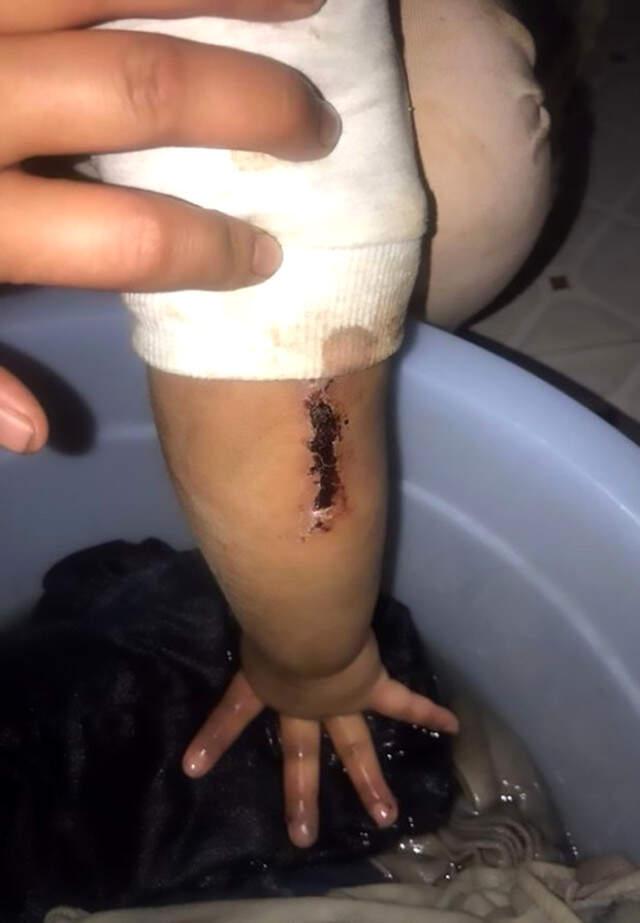 Babasının İşkence Edip Tuvalete Zincirlediği 4 Yaşındaki Kızı, Eve Gelen Misafir Kurtardı