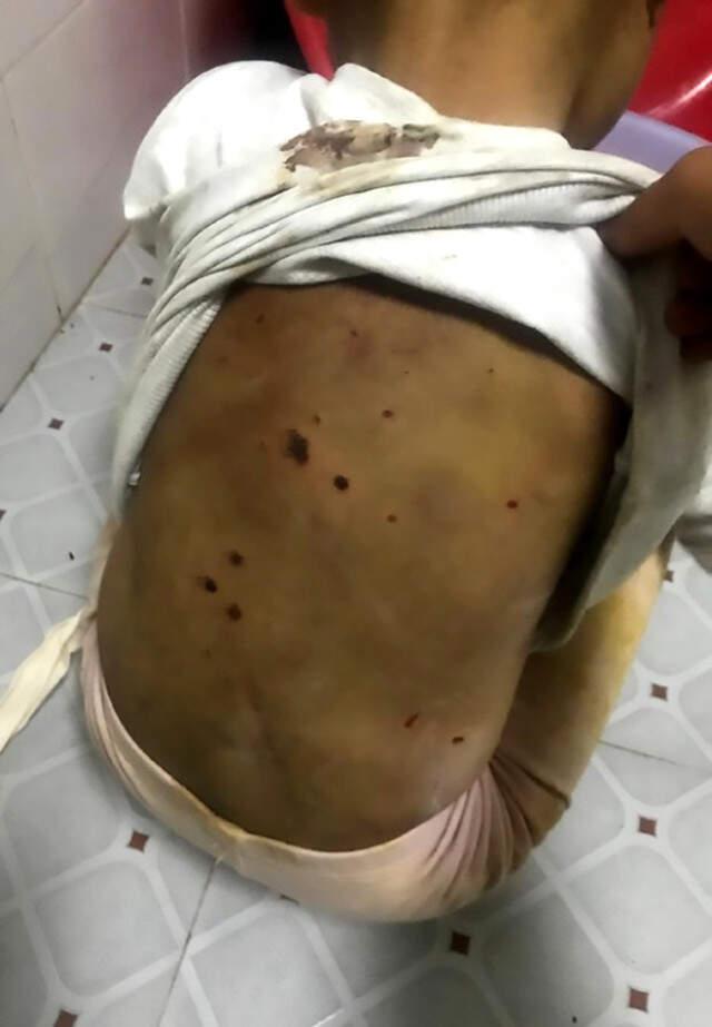 Babasının İşkence Edip Tuvalete Zincirlediği 4 Yaşındaki Kızı, Eve Gelen Misafir Kurtardı