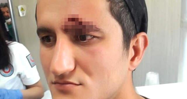 Öfkeli Koca Eşini Azarlayan Diş Hekiminin Kaşını Patlattı