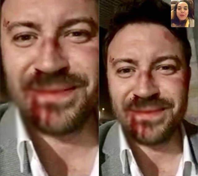 Ünlü Oyuncu Tolga Güleç'in Kanlar İçerisindeki Görüntüsü Gündeme Bomba Gibi Düştü