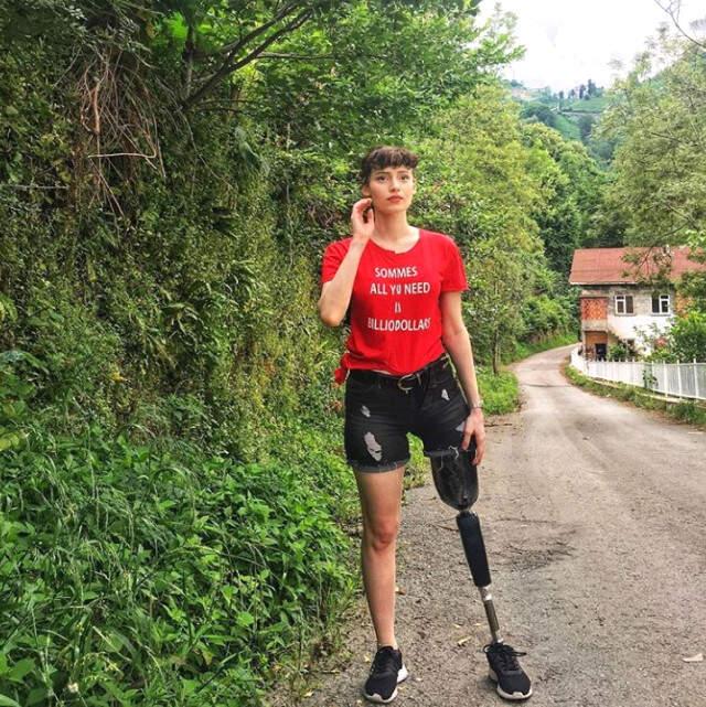 Kanserden Bacağını Kaybeden Genç Kız 3. kez Kansere Yakalandı