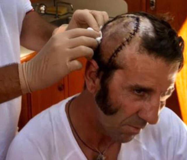 İspanya'da Kızgın Boğa, Yüzlerce Kişinin Önünde Matadorun Kafa Derisini Yüzdü