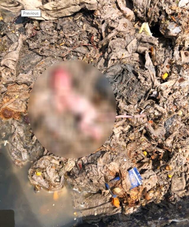 Zonguldak�ta Kanalizasyon İçerisinde Yeni Doğmuş Bebek