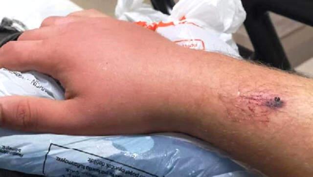 Sağlık Bakanlığı: Aref, Mısır'a Özel Ambulans Uçakla Nakil Edildi
