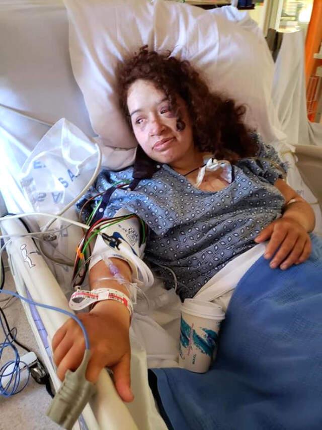 Uçuruma Yuvarlanan Genç Kadın Radyatör Suyu İçerek Hayatta Kaldı