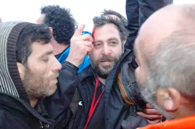 Nejat İşler Saldırıya Uğradı Nejat İşler Saldırıya Uğradı