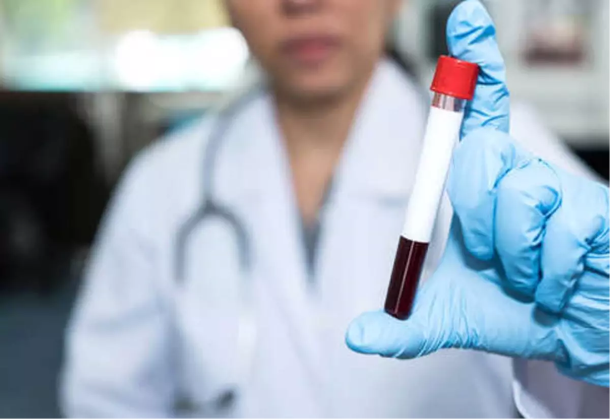 Hepatit C Nedir, Nasıl Bulaşır?
