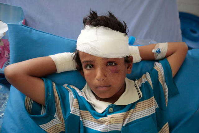 Dünyaca Ünlü Aktör Jim Carey, Yemen'de Çocukların Ölümüne Tepki Gösterdi