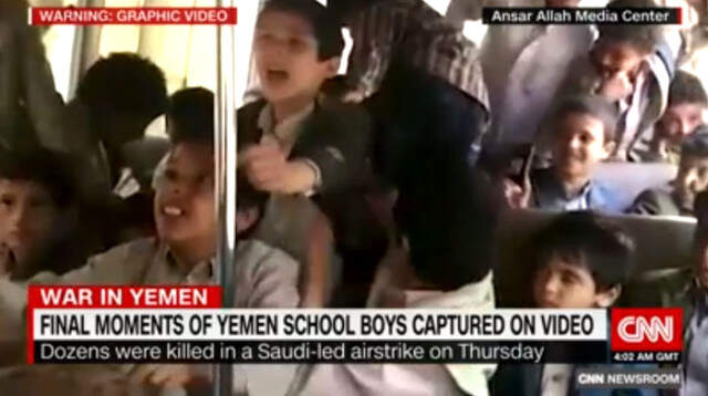 Dünyaca Ünlü Aktör Jim Carey, Yemen'de Çocukların Ölümüne Tepki Gösterdi