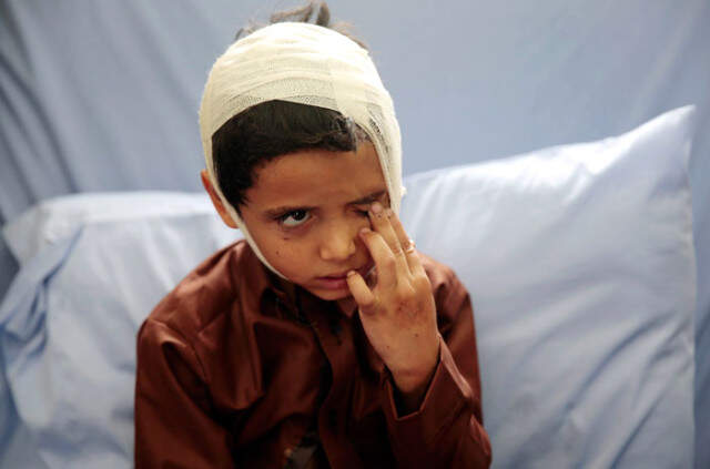 Dünyaca Ünlü Aktör Jim Carey, Yemen'de Çocukların Ölümüne Tepki Gösterdi