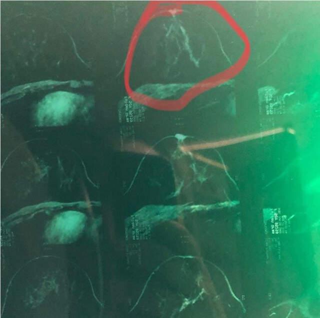 Meme Kanseri Teşhisi Koyulan Şarkıcı Fulden Uras, Ameliyat Olmadan Önce Sevenlerinden Dua İstedi