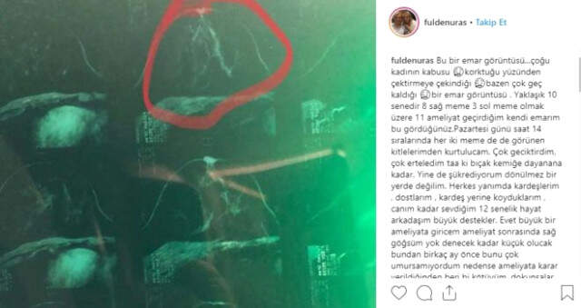 Kanser Teşhisi Konmuştu! Fulden Uras Kimdir?