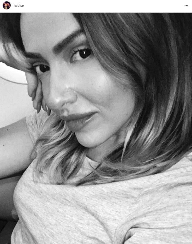 Hadise, Son Paylaşımındaki Görüntüsüyle Takipçilerini Şaşkınlığa Uğrattı