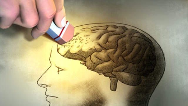 Bugün 21 Eylül Dünya Alzheimer Günü! Alzheimer Hastalığı Nedir, Nasıl Anlaşılır?