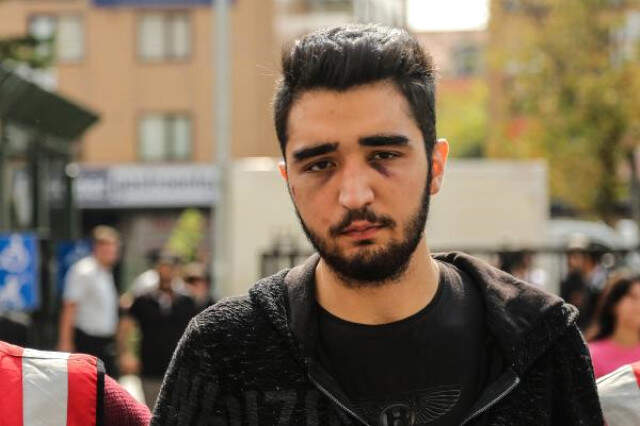 Otomobiliyle Yayaları Ezen Sürücünün Dövdüğü Kız Arkadaşı: Kalabalık Artınca Vatandaşların Üstüne Sürdü