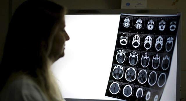 Rusya'da Burnu Tıkanan Adam, Nefes Almak İçin Bıçakla Başını Deldi