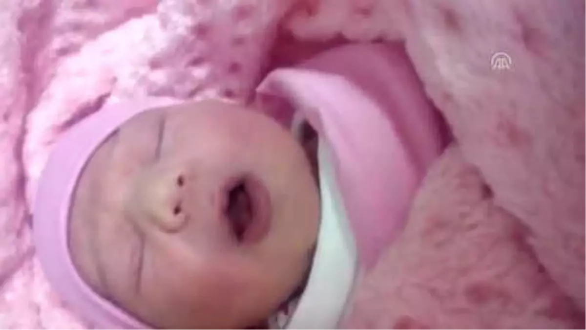 Dokuz Dişli Doğan Bebek Şaşırttı