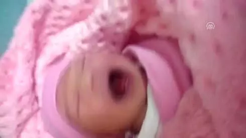 dokuz disli dogan bebek sasirtti haberler