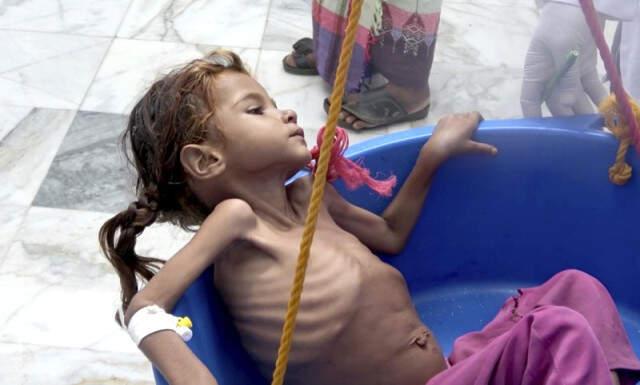 Yemenli Çocuklar Hayatta Kalmak İçin Üzüm Yaprağı Yiyor