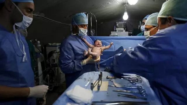 Sezaryen Doğum Oranı Artıyor; Gelir Seviyesi Düşük Aileler Bu İmkandan Faydalanamıyor