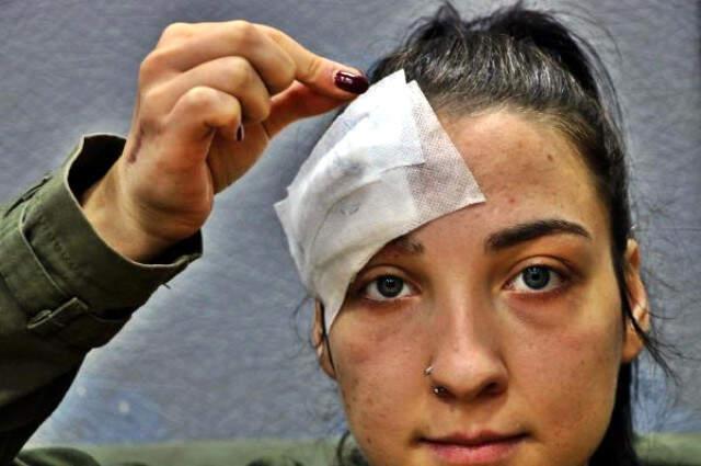 Damla'nın Alnında Unutulduğu İddia Edilen İğneye İnceleme