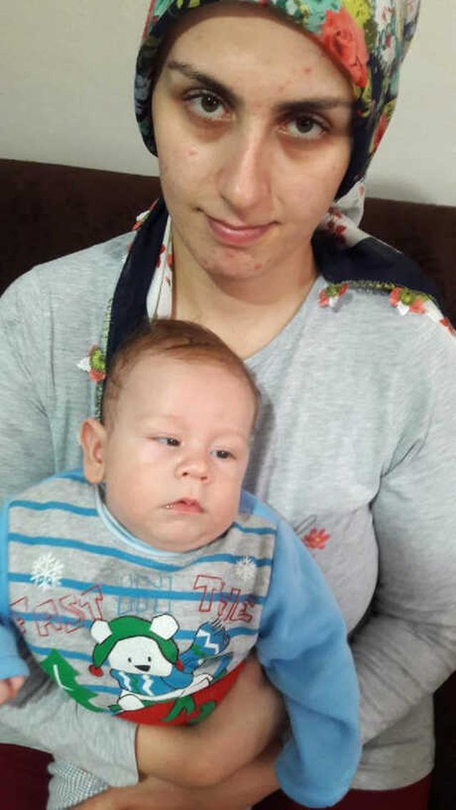 Katarakt Olan 3 Aylık Yunus Emre Bebek Yardım Bekliyor