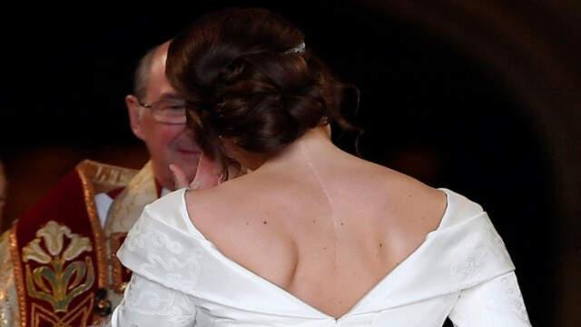 Kraliçe Elizabeth'in Torunu Prenses Eugenie, Sırtındaki Ameliyat İzlerinin Herkesi Örnek Olması İçin Duvak Takmadı