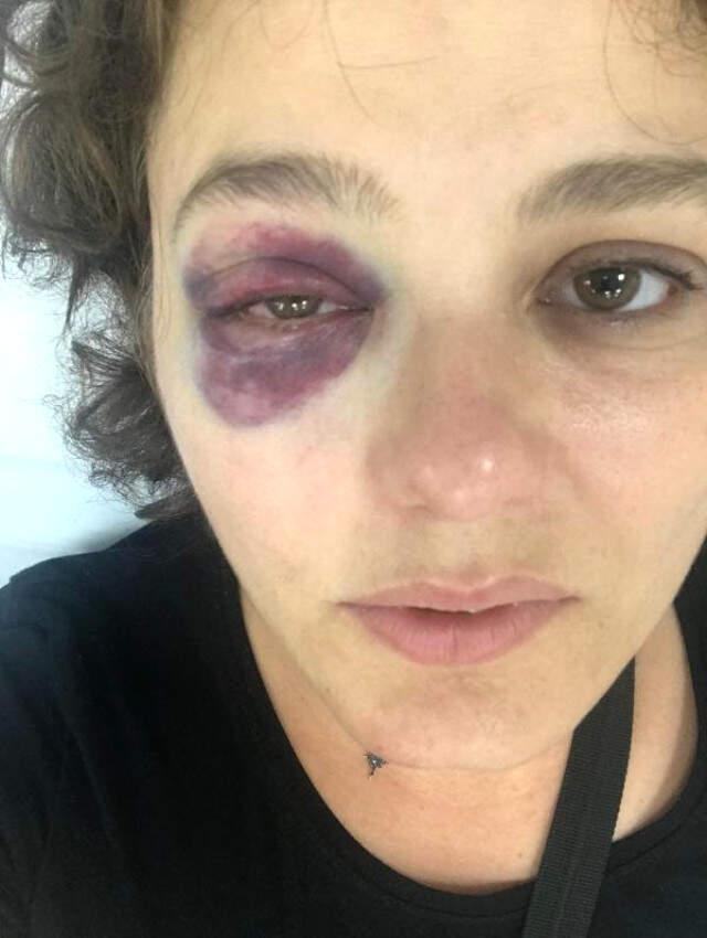 Kadıköy'de Saldırgan, 'Senin Havan Kime' Deyip Restoranda Yemek Yiyen Kadına Yumruk Attı