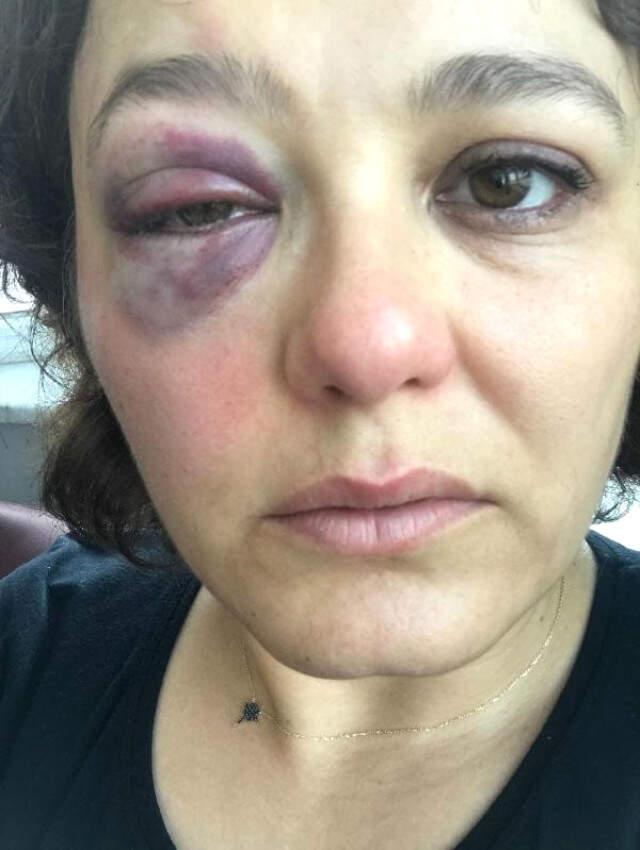 Kadıköy'de Saldırgan, 'Senin Havan Kime' Deyip Restoranda Yemek Yiyen Kadına Yumruk Attı