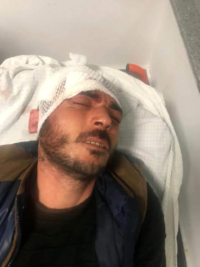 Esnaf, Yeğeninin Olayı İle İlgili Polise ''Nasıl Oldu'' Diye Sorunca Tekme Tokat Dayak Yedi