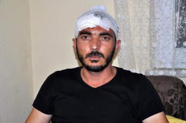Esnaf, Yeğeninin Olayı İle İlgili Polise ''Nasıl Oldu'' Diye Sorunca Tekme Tokat Dayak Yedi