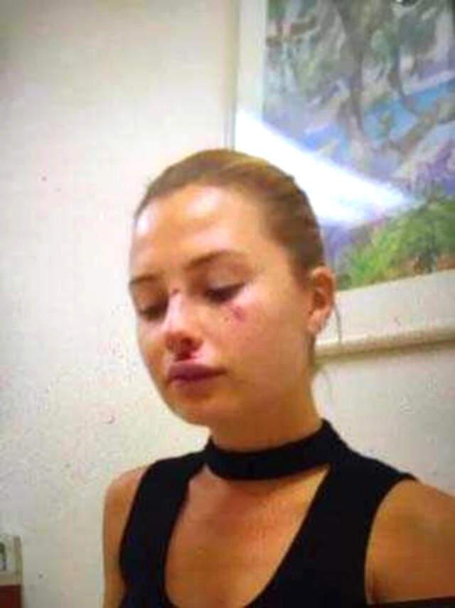 Kaza Yapan Eşi Chloe Loughnan'ın Yanına Gitmeyen Serdar Ortaç, Dedikodulara Son Noktayı Koydu