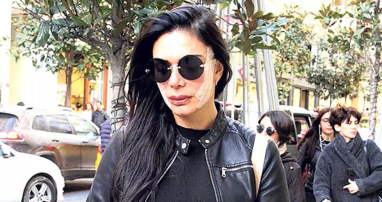 Kim Kardashian'a Benzemek İsteyen Sevda Demirel Yüzünde Bandajla Geziyor