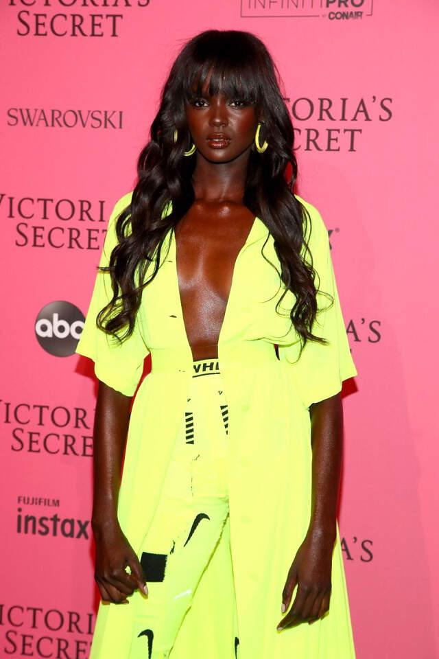 Victoria's Secret Meleği Neredeyse Ölüyordu!