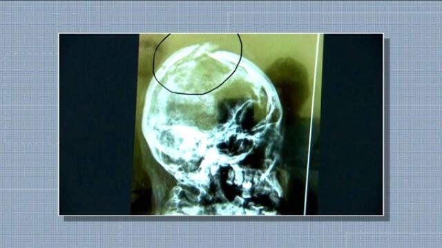 Kayınpeder ve Kayınvalide Oğlundan Ayrılmak İsteyen Gelinini Diri Diri Toprağa Gömerek Öldürdü