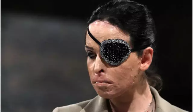 İtalya'da Eski Miss İtalya Finalisti Sevgilisine Asitle Saldıran Erkeğe 15 Yıl Hapis