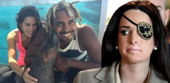 Model Gessica Notaro'nun Yüzüne Asitle Saldıran Eski Sevgilisi, 15 Yıl Hapis Cezası Aldı