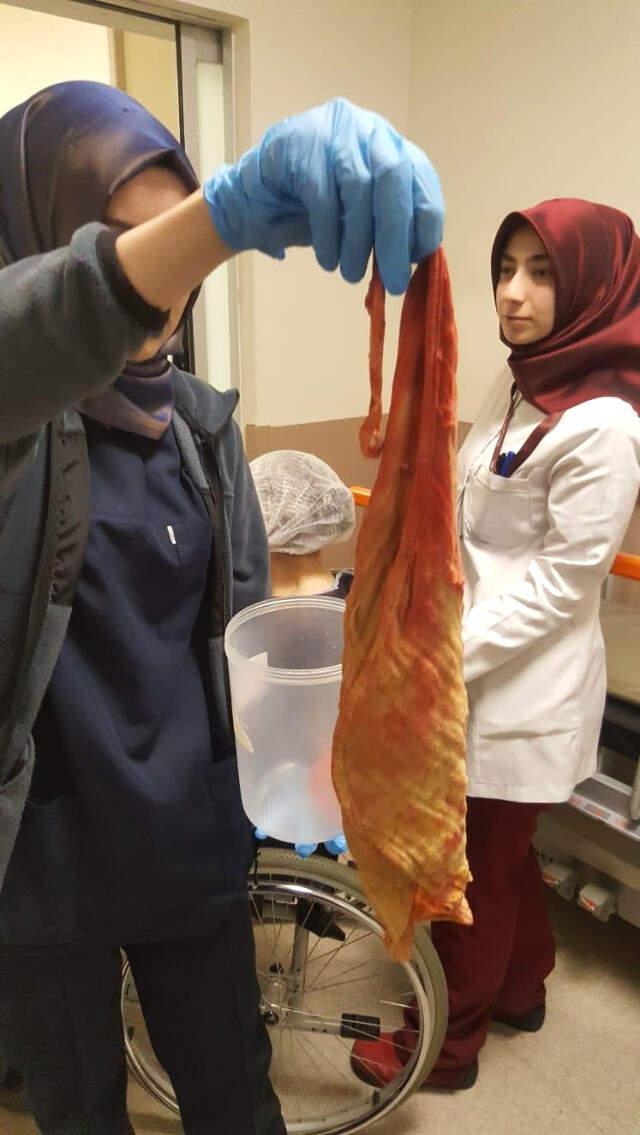 Hastanın Karnında Havlu Büyüklüğünde Sargı Bezi Unutmuşlar