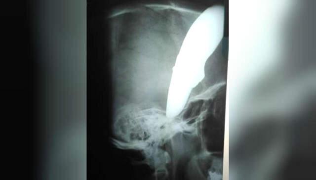 Başına Bıçak Saplanan Adam Hastaneye Gidip, 'Müsait Bir Doktor Var mı?' Diye Sordu