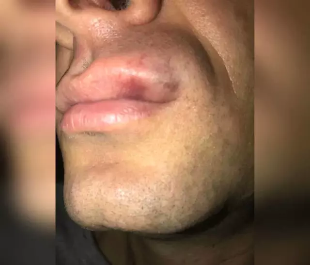 Hakeme Kafa Atan Futbolcuya 20 Maç Ceza