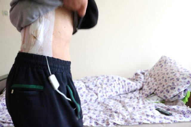Karın Ağrısıyla Hastaneye Giden Talihsiz Adam'ın, Yanlış İğne Sonucu Kolu ve Bacağı Felç Oldu