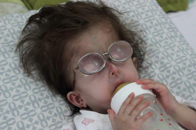 2 Yaşındaki Hatice, Hastalığı Nedeniyle 3 Aylık Bebek Gibi Görünüyor