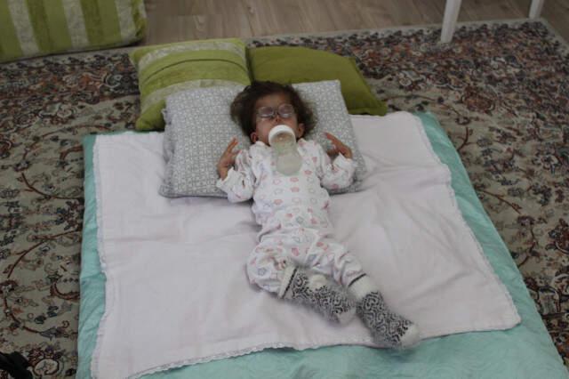 2 Yaşındaki Hatice, Hastalığı Nedeniyle 3 Aylık Bebek Gibi Görünüyor