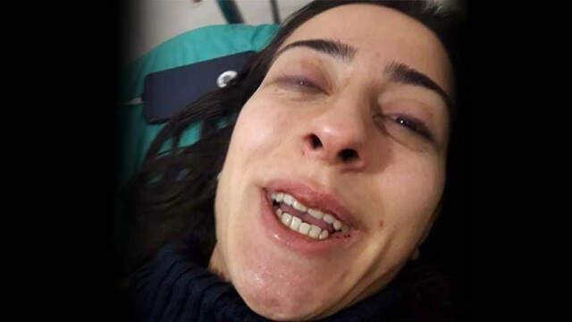 Ankara'daki Tren Kazasından Yaralı Kurtulan Vatandaş: Büyük Bir Gürültüyle Yerimizden Fırladık